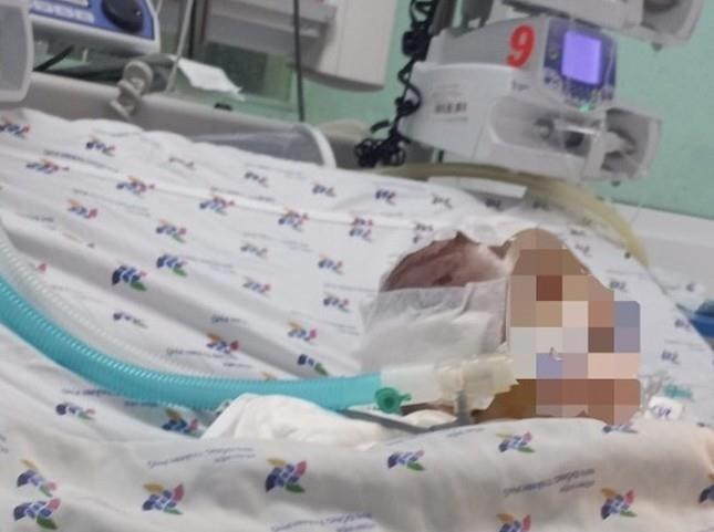 Bé 6 tháng tuổi bị đánh dập não: Nạn nhân thương tích 99% - 1