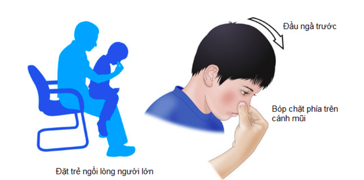 Nhiều người chảy máu cam mùa đông, dấu hiệu nào nên đi viện ngay? - 1