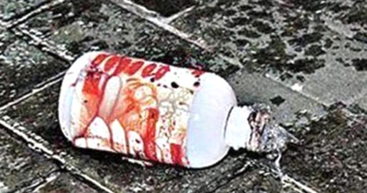 Bị từ chối tình cảm, gã đàn ông thuê người tạt axit nhân viên quán karaoke - 1