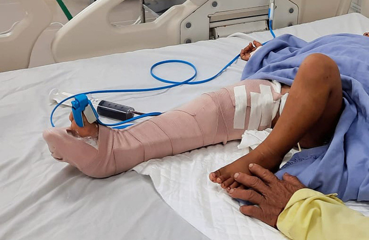 Ô tô chở khách đi chùa gây tai nạn khi xuống dốc, 2 người thương vong - 1