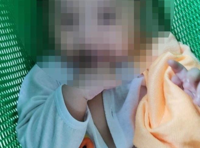Bé 6 tháng tuổi bị bảo mẫu bạo hành vẫn hôn mê sâu - 1