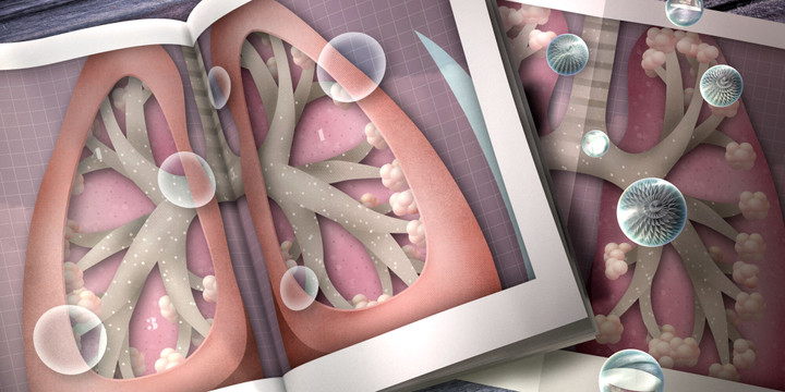 Căn bệnh gây suy hô hấp cấp cho trẻ nhưng dễ bị nhầm lẫn với bệnh vặt - 1