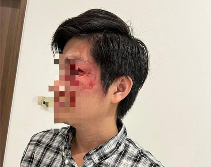 TP.HCM chỉ đạo xử nghiêm vụ chủ chó đấm người tại chung cư - 2