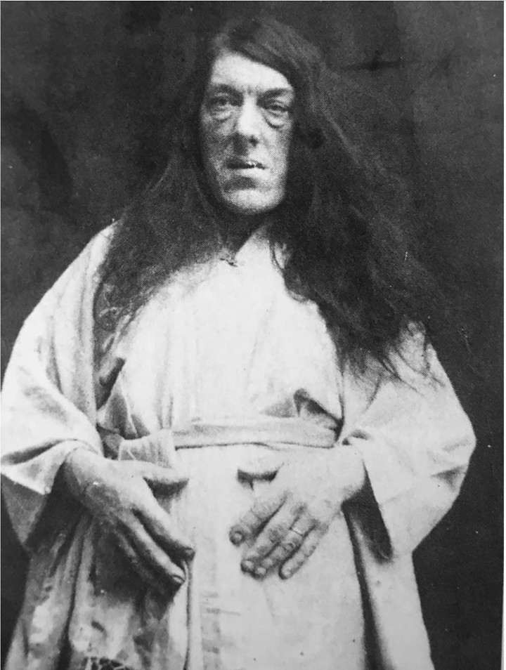 Ảnh hiếm và bi kịch của người phụ nữ xấu xí nhất thế giới - 2