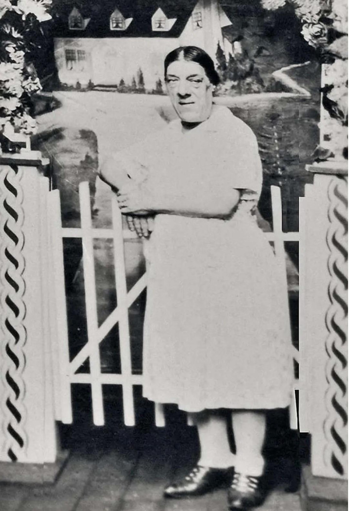 Ảnh hiếm và bi kịch của người phụ nữ xấu xí nhất thế giới - 3