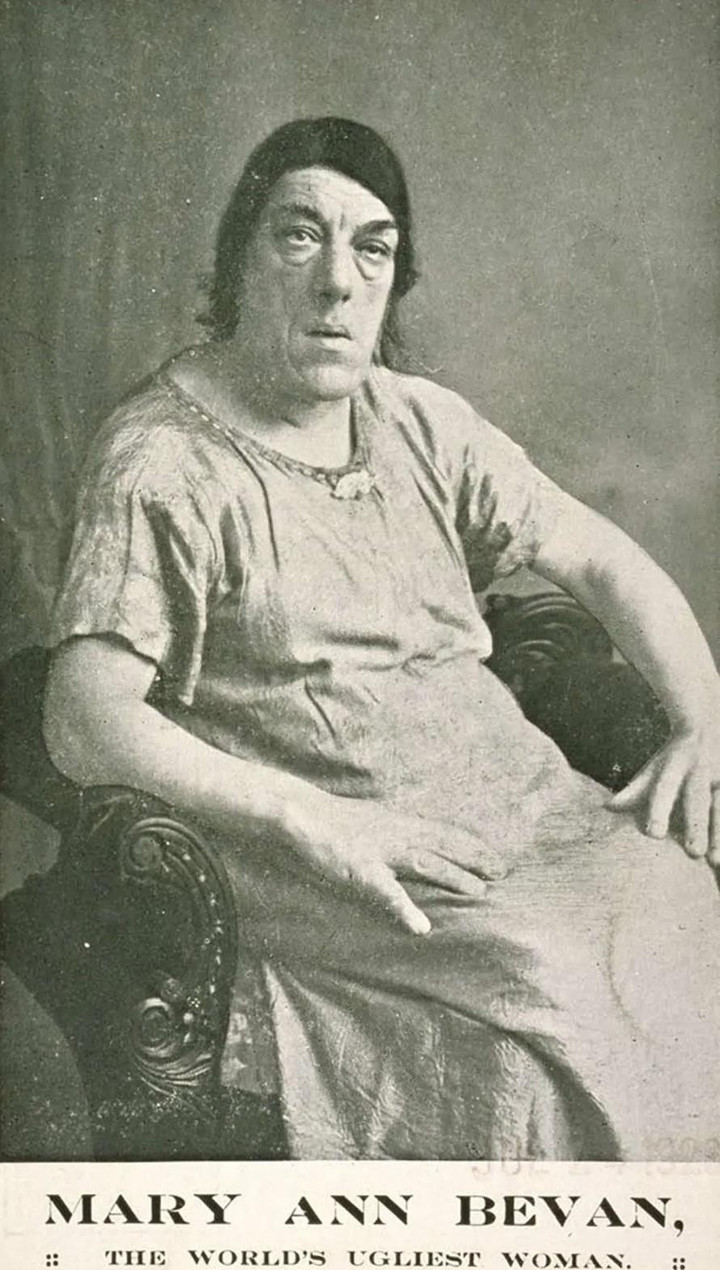 Ảnh hiếm và bi kịch của người phụ nữ xấu xí nhất thế giới - 4