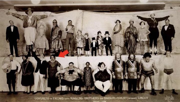 Ảnh hiếm và bi kịch của người phụ nữ xấu xí nhất thế giới - 6