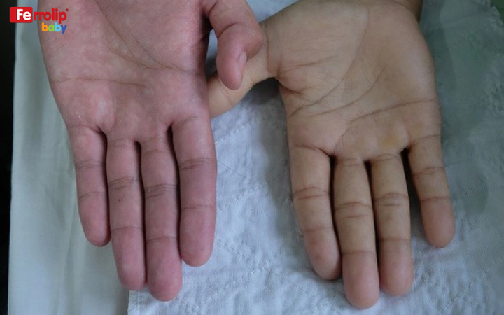 Chuyên gia giải đáp 'Có nên bổ sung sắt cho trẻ sơ sinh' - 3