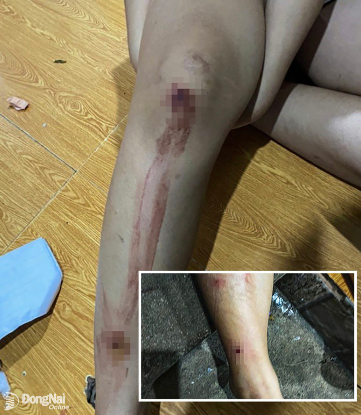 Truy bắt kẻ nổ súng khiến 2 chị em bị thương ở Đồng Nai - 1