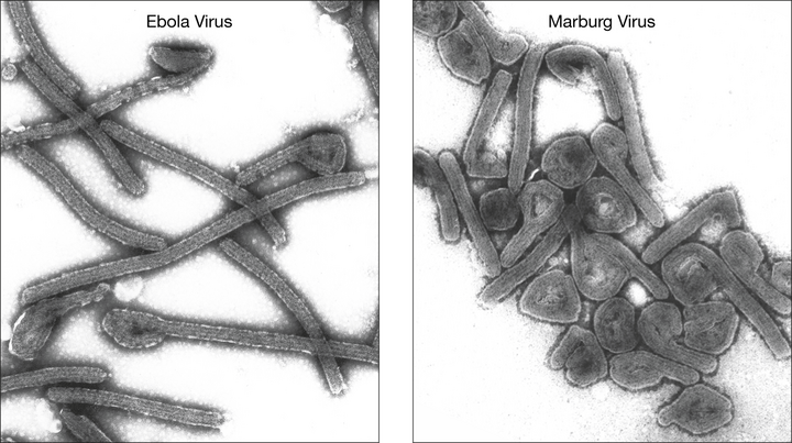 Virus Marburg và Ebola giống nhau không? - 2