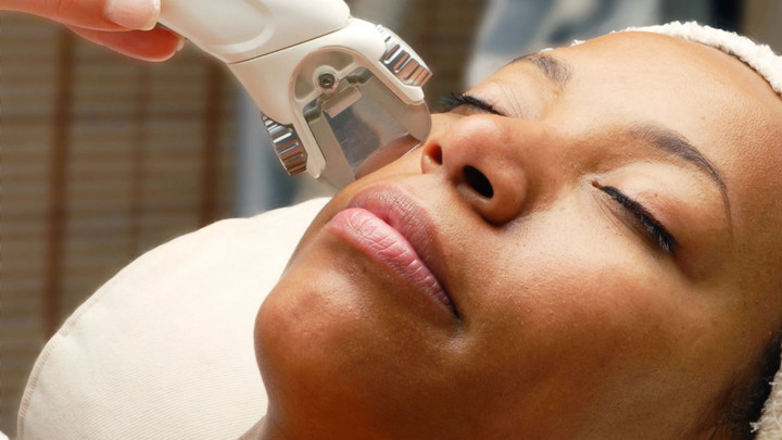 Cấy tóc, mọc tóc, giảm mỡ bụng - máy lazer làm được hết: Chuyên gia nói gì? - 1