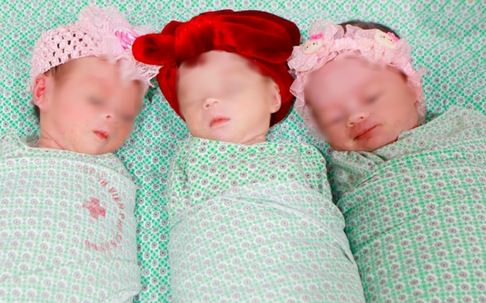 Sản phụ sinh 3 tự nhiên cùng trứng hiếm gặp, 200.000 ca sinh mới có một - 1