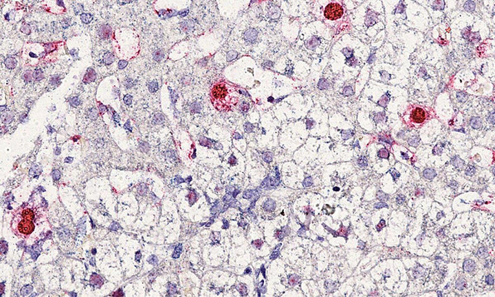 Phát hiện virus mới gây bệnh viêm gan ở người - 1