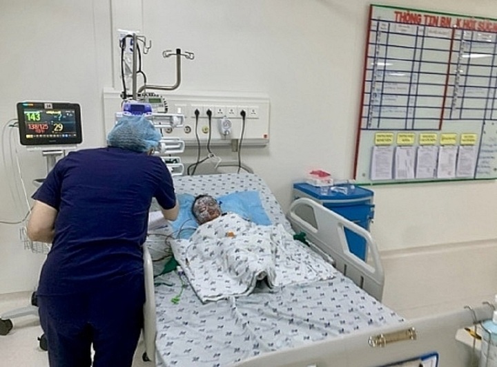 Phòng tránh tai nạn bỏng cho trẻ nhỏ thế nào? - 1