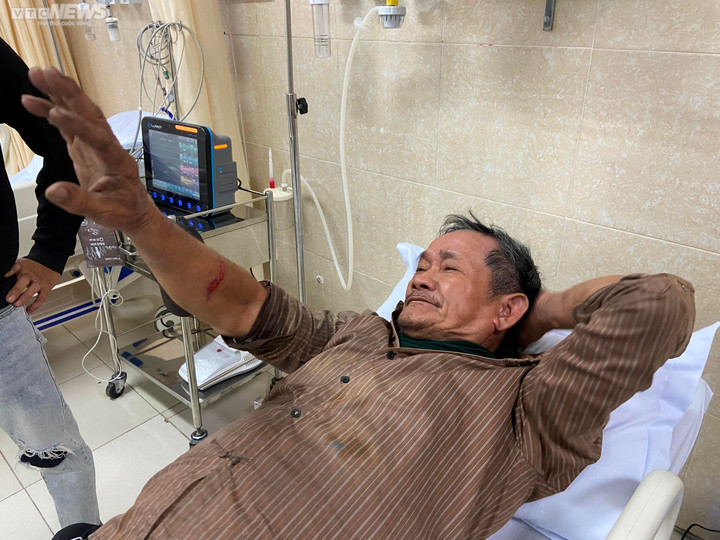 Thanh kim loại hàng chục kg rơi từ trên cao, trúng người đi đường ở Nha Trang - 2