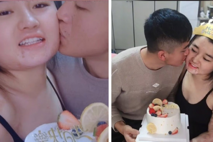 Chàng trai chăm sóc cho bạn gái bỏng nặng khiến cộng đồng mạng cảm động - 1