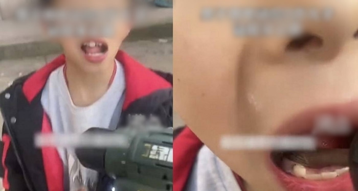 Bé trai 9 tuổi đau răng phát khóc, nào ngờ bố làm điều ai cũng sợ - 1