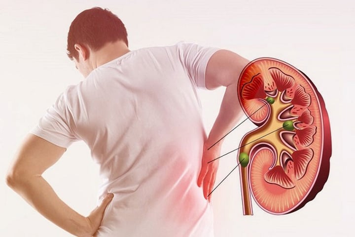 Những người không nên dùng tảo biển - 1