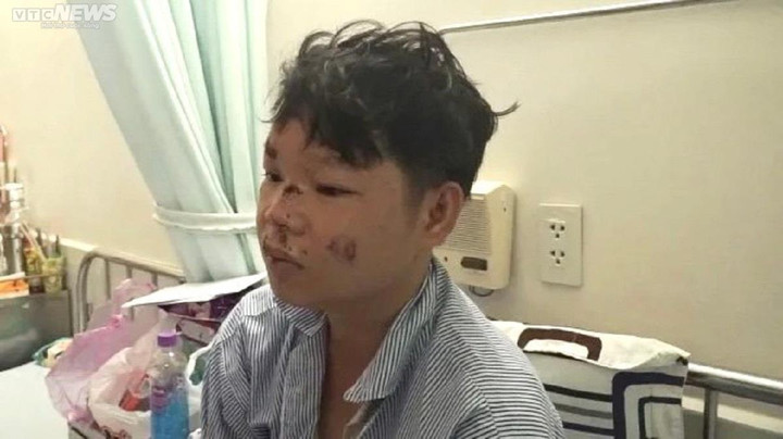 Lời kể của tài phụ vụ lật xe chở dưa ở Phú Yên khiến 9 người thương vong - 1