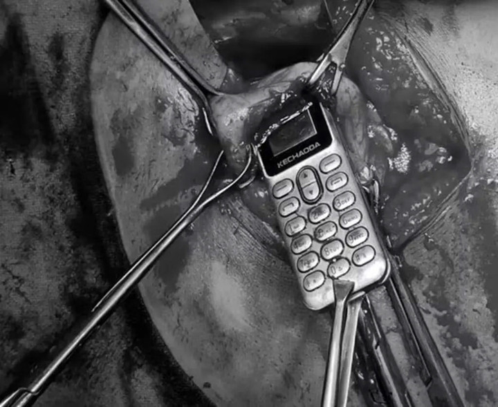 Cãi nhau với em trai, chị gái nuốt luôn điện thoại vào bụng - 2