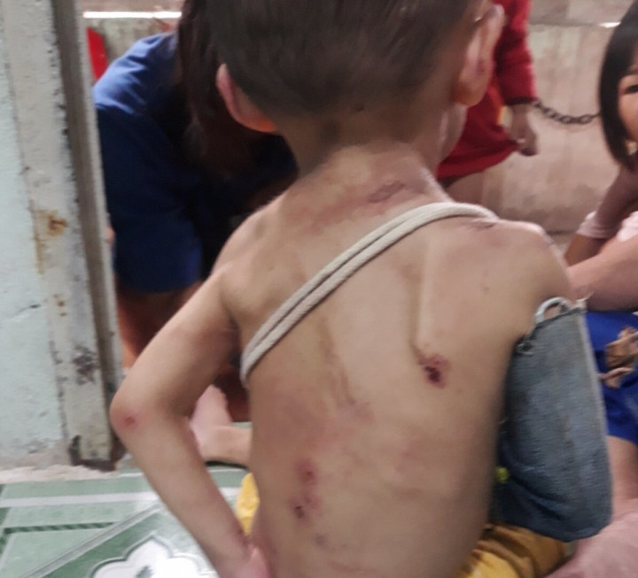 Bé trai 1 tuổi ở TP.HCM có dấu hiệu bị cha mẹ bạo hành - 1