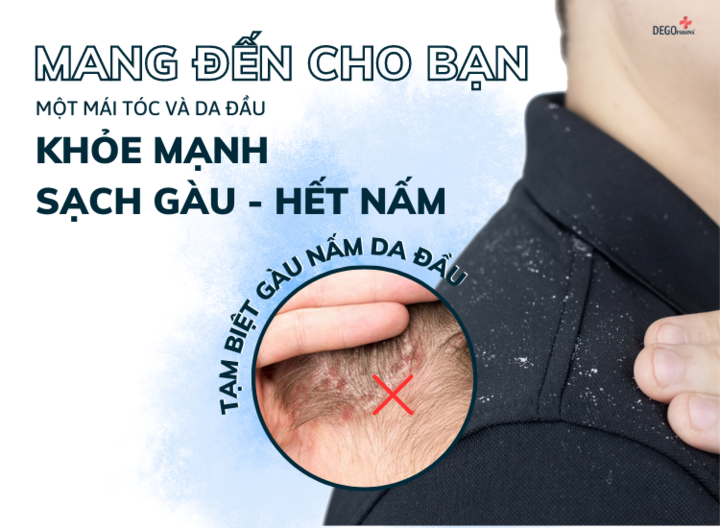 Dego Pharma: Xóa bỏ nỗi lo nấm da đầu - 3