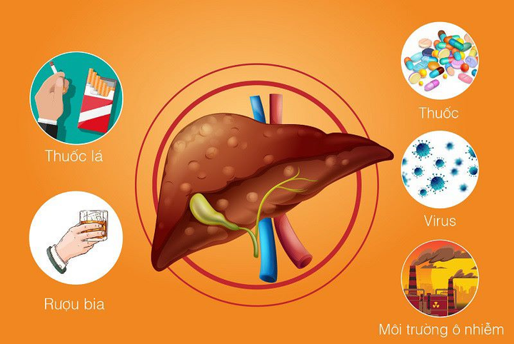 MEDLATEC miễn phí khám gan mật cùng chuyên gia đầu ngành - 1