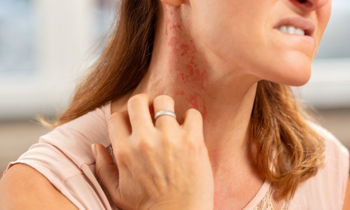 Những người này tuyệt đối không nên ăn hải sản - 1