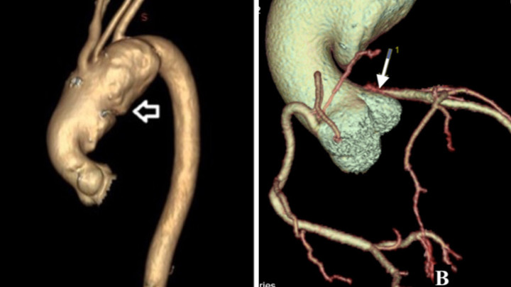 Tình huống đặc biệt khiến bác sĩ phải hạ thân nhiệt người bệnh về dưới 24 độ C - 1