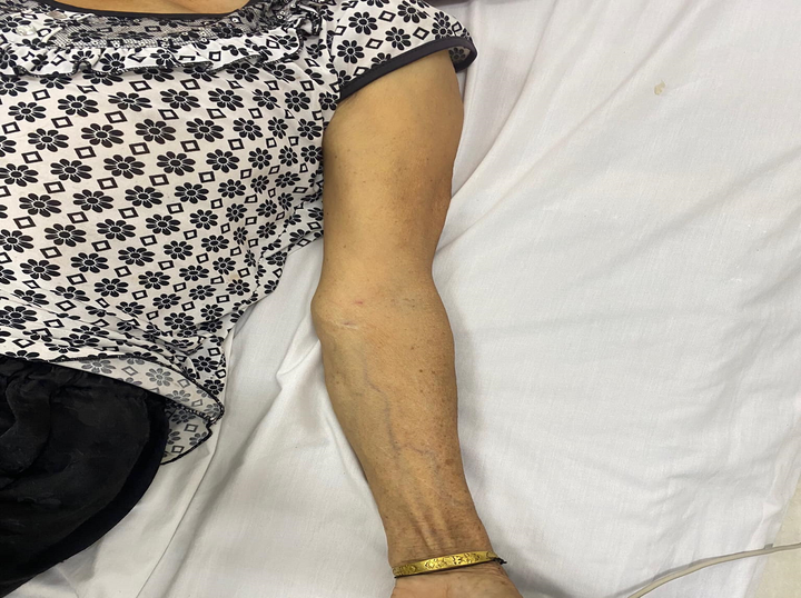 Dùng lá rừng trị táo bón, 1 người ở Nghệ An nhập viện cấp cứu - 1