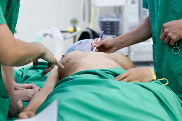 Ngực bị thông khe sau nâng ngực, nguyên nhân do đâu? - 1