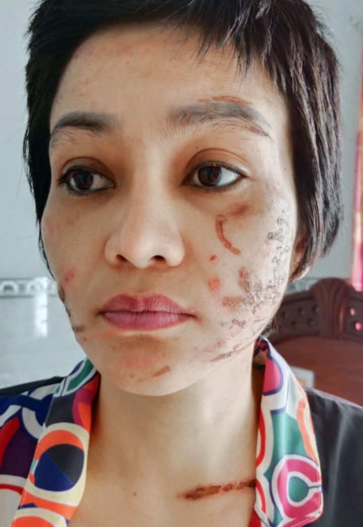 Người phụ nữ mang bầu 7 tháng bị chồng bạo hành dã man - 2