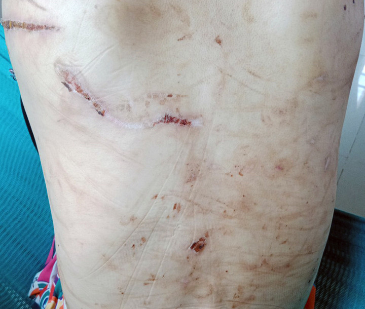 Tin mới nhất vụ vợ bầu 7 tháng tố bị chồng bạo hành dã man như thời trung cổ - 1