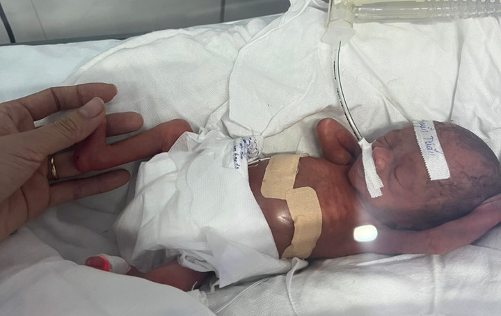 Sự sống kỳ diệu của bé trai sinh non nặng 600g - 1