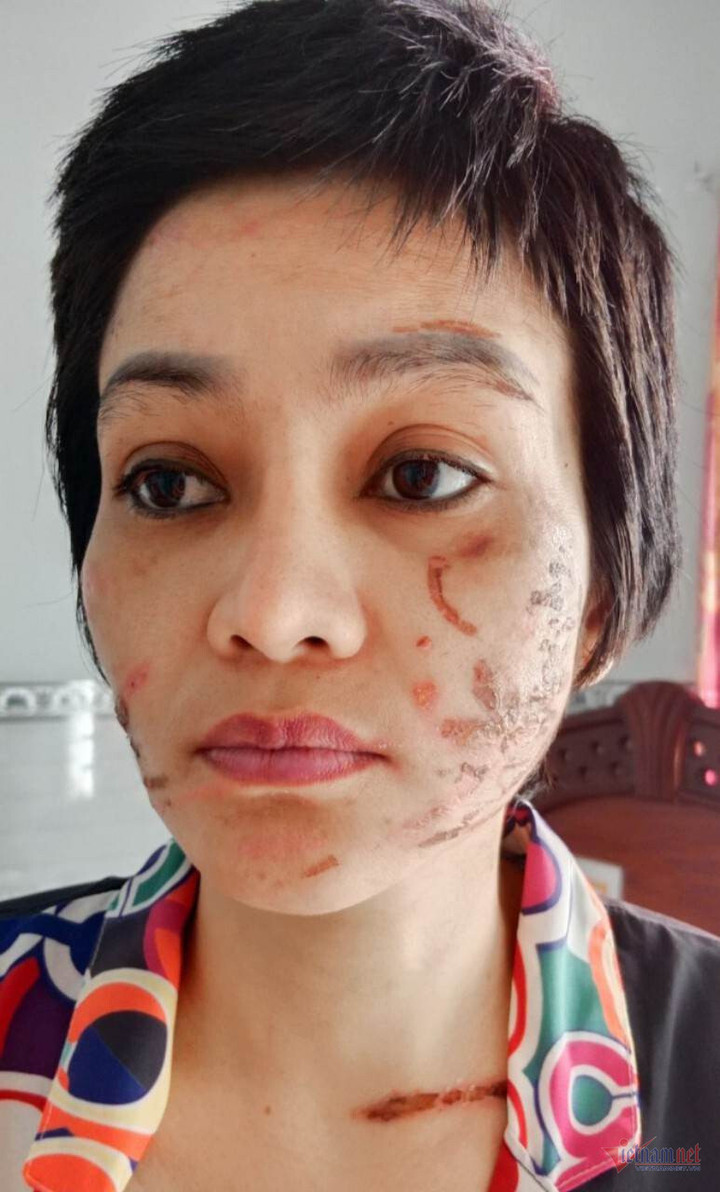 Công an tìm thấy 205 vết thương trên thân thể người vợ mang bầu 7 tháng - 4