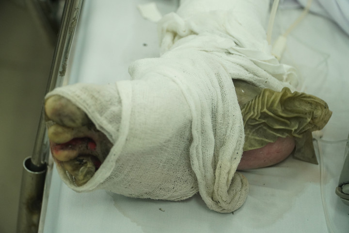 Ghen tuông, đốt phòng trọ ở Đồng Nai: 2 ca tử vong, 1 ca khó qua khỏi - 2