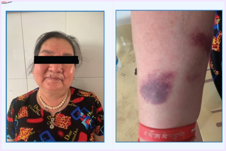 Dùng thuốc giảm đau không rõ nguồn gốc, người phụ nữ nhập viện cấp cứu - 1