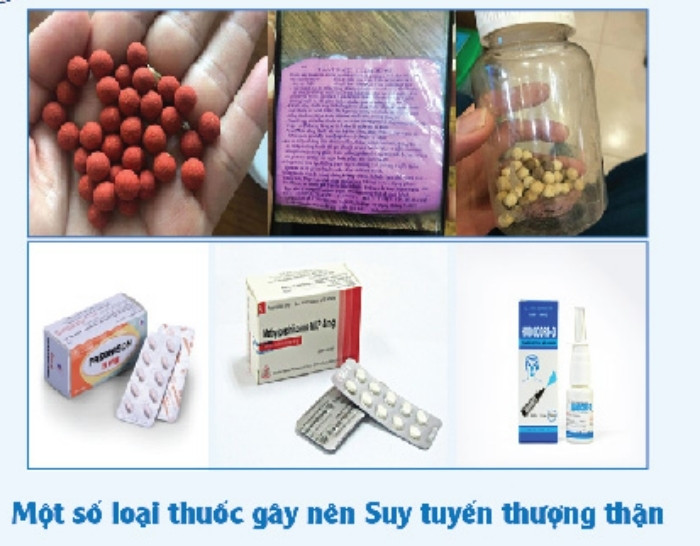 Dùng thuốc giảm đau không rõ nguồn gốc, người phụ nữ nhập viện cấp cứu - 2