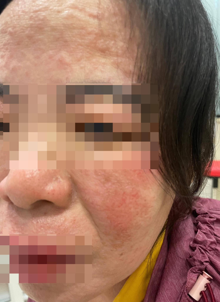 Tin 'viên chống nắng phơi mặt ra da vẫn đẹp', người phụ nữ nhận cái kết đắng - 1