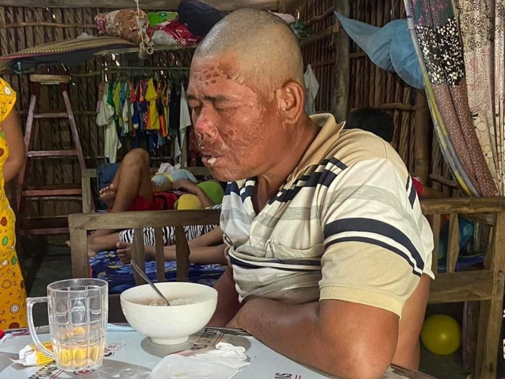 Ngư dân kể chuyện sống sót thần kỳ sau 4 ngày rơi xuống biển - 3