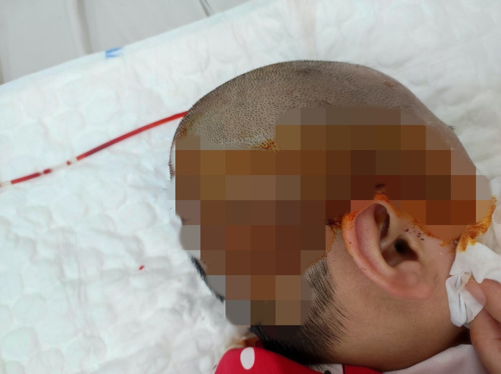 Bé gái 10 tuổi mổ não 4 lần, liệt nửa người vì ung thư - 3