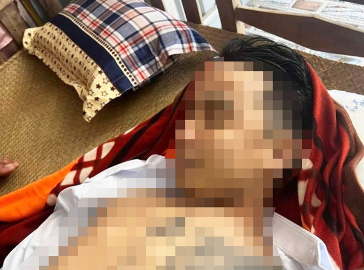 Long An: Bắt tạm giam nhóm người sát hại nam thanh niên - 1