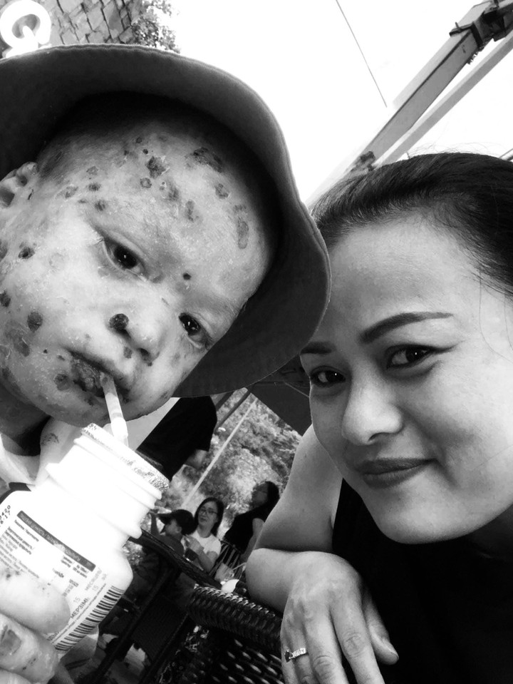 Mẹ Lan luôn là chỗ dựa tinh thần cho Kem chiến đấu cùng bệnh tật. (Ảnh NVCC)