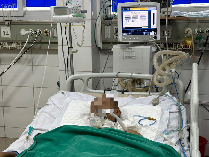 Trong quá trình nằm điều trị bệnh uốn ván hơn 1 tháng tại khoa Hồi sức tích cực, bệnh nhân phải mở khí quản, thở máy. (Ảnh: BVCC)