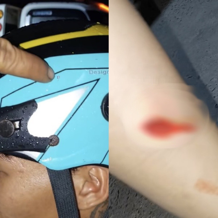 Đối tượng lạ mặt được cho là dùng vật giống súng hơi bắn một phát trúng vào nón bảo hiểm của người chồng và một phát trúng vào bắp chân trái người vợ.