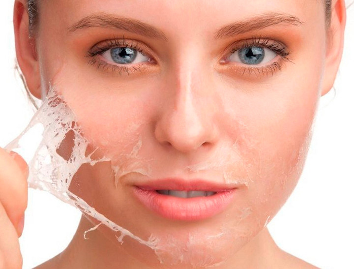 Da mất độ ẩm là do yếu tố ngoại cảnh, chế độ ăn uống và thói quen sinh hoạt.