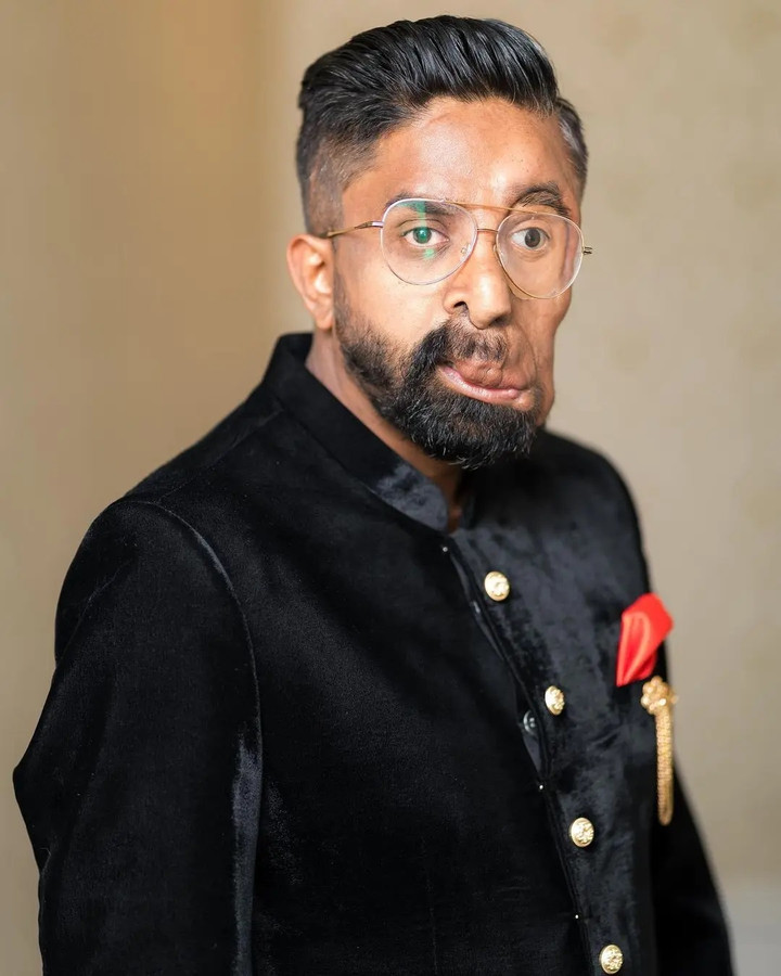 Câu chuyện xúc động đằng sau đôi mắt giả kỳ lạ của người đàn ông Anh - 3