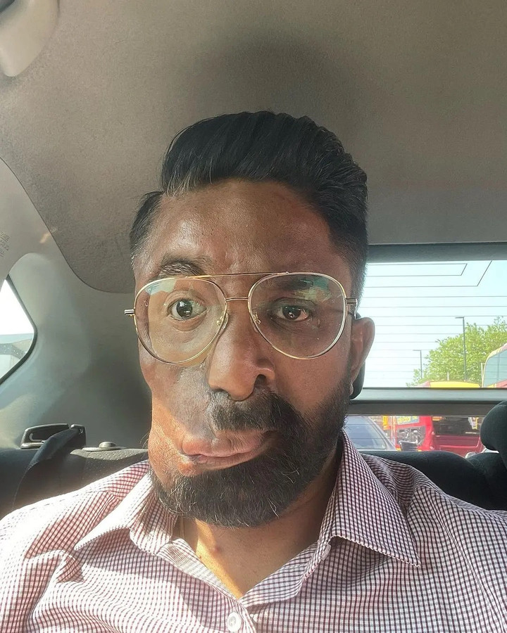 Câu chuyện xúc động đằng sau đôi mắt giả kỳ lạ của người đàn ông Anh - 1