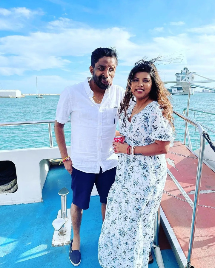 Câu chuyện xúc động đằng sau đôi mắt giả kỳ lạ của người đàn ông Anh - 5