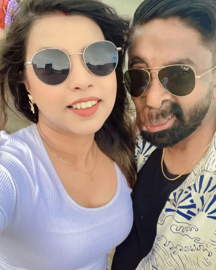 Câu chuyện xúc động đằng sau đôi mắt giả kỳ lạ của người đàn ông Anh - 4